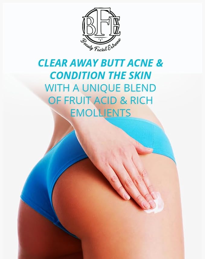 Anti-Acne Buttocks & Thigh Treatment- Clears Away Acne, Pimples, Zits, Dark Spots & Ingrown Hairs on the Buttocks &Thigh Area. Prevents Future Breakouts 6.9 OZ