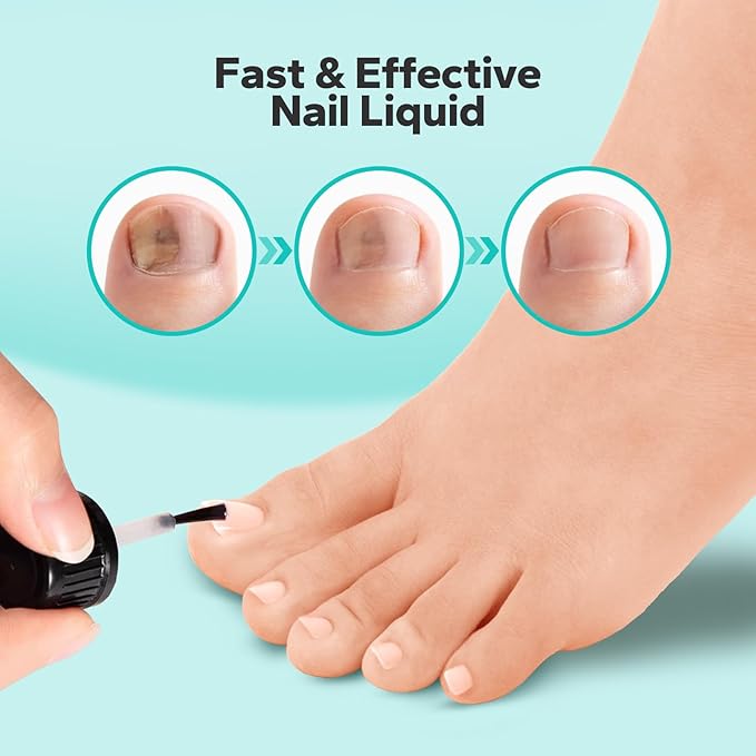 Choppie Extra Strength Nail Care Solution (1.69 Fl oz), Intensive Support for Hands & Feet, Foot Care Formula