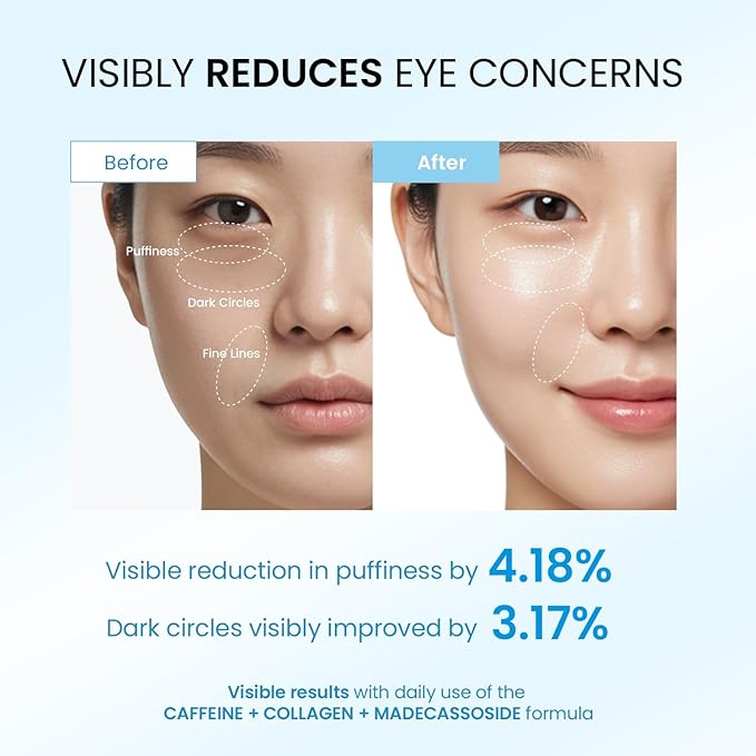 Dongyu Caffeine Under Eye Cream: Anti Aging Firming Collagen Eye Care - Puffy Eye Treatment for Beauty Enthusiasts Morning Night Daily Use (Light Blue)