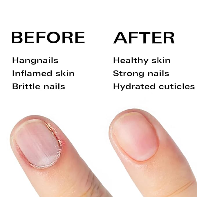 Beauty Power Cuticle Oil Pen - Strawberry Scent, Vitamin E Nail Strengthener and Growth Serum for Nail Care, Nourishing and Hydrating Formula for Healthier, Stronger Nails