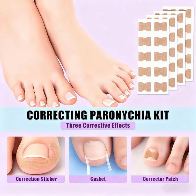 Ingrown toenail removal kit (Type A): Contains corrector, breathable/curved corrector strips, painless file, nail remover and pedicure tools, suitable for both men and women.