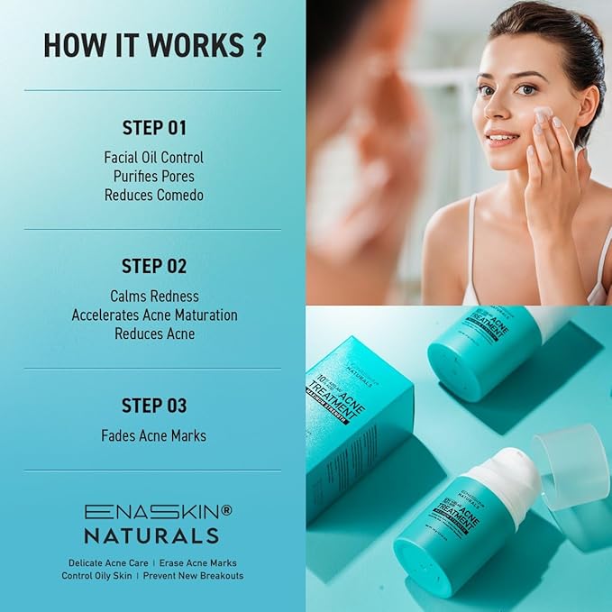 Salicylic Acid Acne Spot Treatment: Cystic Hormonal Pimple Cream for Stubborn Zits, Blemish Breakout & Post-Acne Scars - Face, Body & Back, Teens-Adults, 1.8 oz