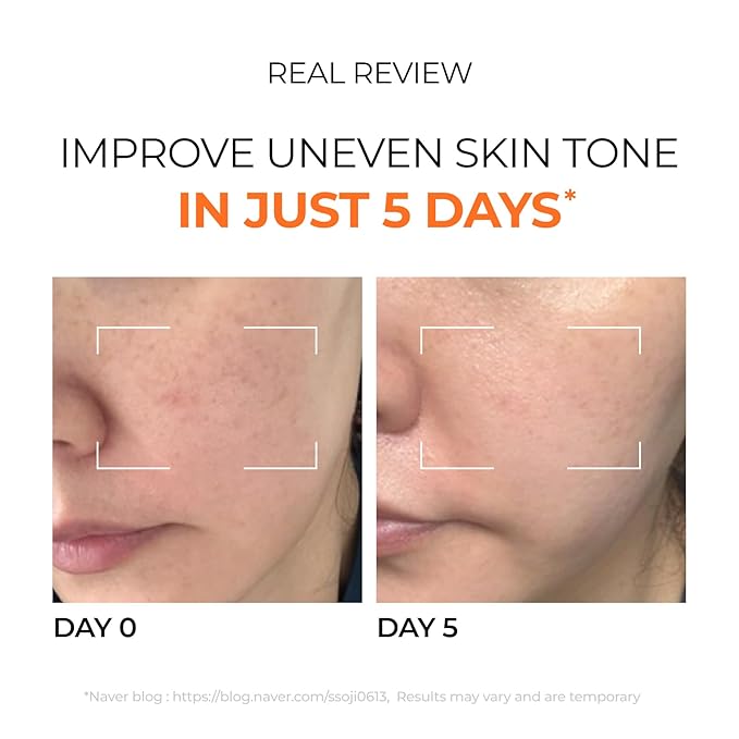 DOMINAS 10% Tranexamic Acid + 5% Mandelic Acid + 5% Niacinamide Brightening Serum, Powerful Dark Spot Corrector for Face, Fast Results in 2 Weeks, 1.01 fl oz