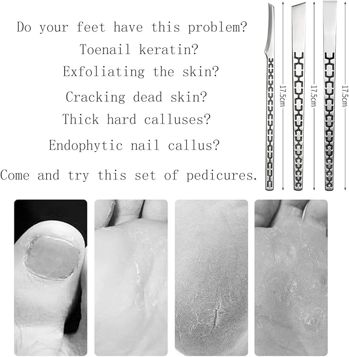 3PCS Stainless Steel Ingrown Toenail Pedicure Knife Set, Professional Pedicure Tool Peeling Knife for Nail Corn Callus(with Whetstone)
