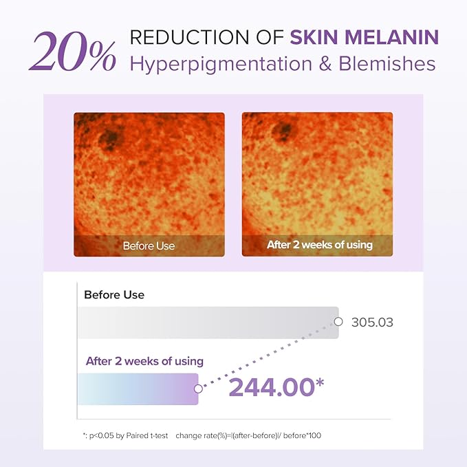 Mary&May Tranexamic Acid (TXA)+Glutathione Eye Cream | Dark Circles & Hyperpigmentation | With Niacinamide & Vitamin C | Firms Under Eye Area | Wrinkle & Fine Line Care | Korean Skincare, 1.01 oz.