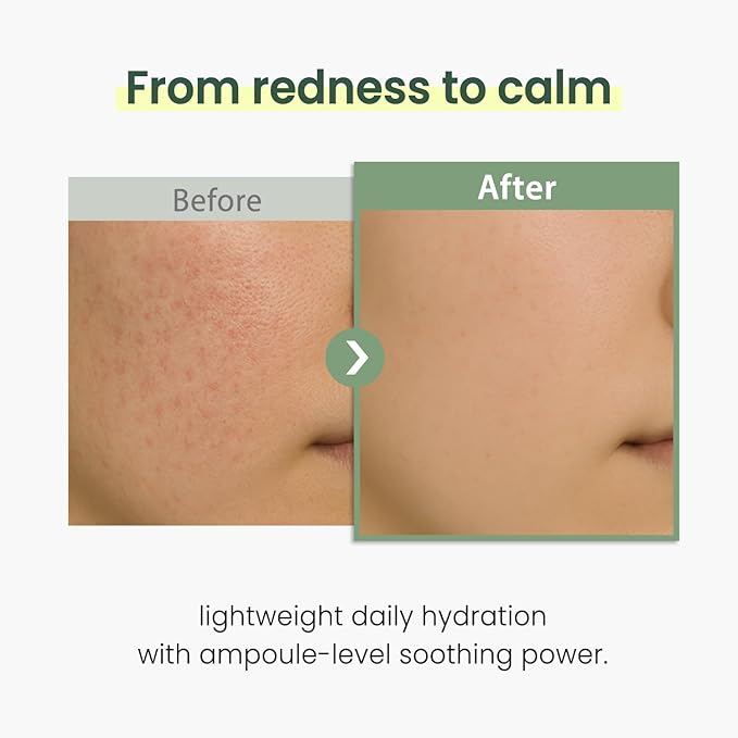 The Skin House Plum & Panthenol Calming Moisturizer for Sensitive Skin | Redness Relief, Soothing Hydration & Barrier Support | Lightweight, Non-Irritating Daily Face Cream [70ml,2.37 oz]