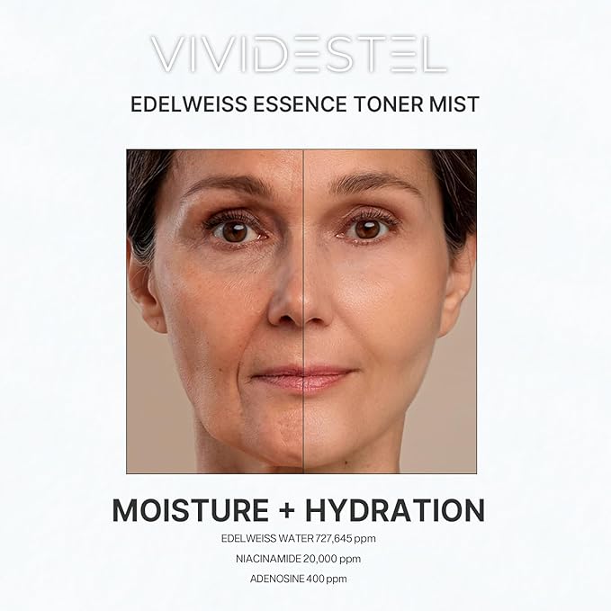 Edelweiss Essence Toner Facial Mist - 727,645 ppm Edelweiss Flower Extract Essence Facial Toner Skin Mist - No Water & Oil Added - Edelweiss Extract and Niacinamide Facial Spray - 100ml