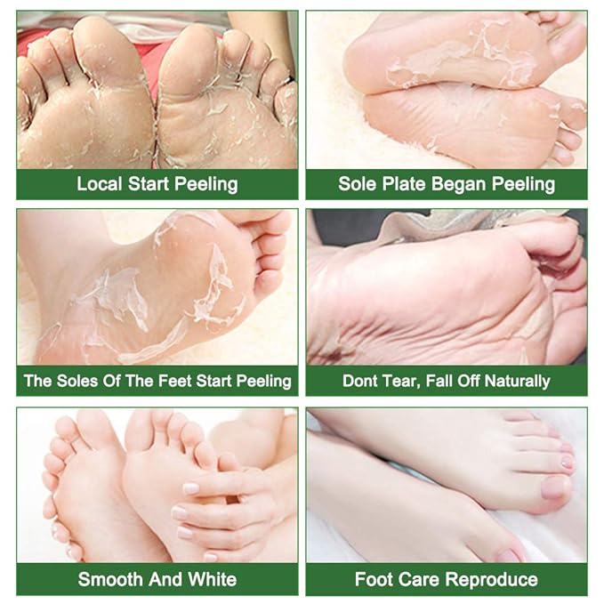 Liefiet Foot Peeling Mask 5 Pack, Foot Mask Remove Dead Skin, Rough Callus and Cracked Heels, Dry Skin Moisturizer for Soft and Smooth Baby Touch Feet (Tea Tree)