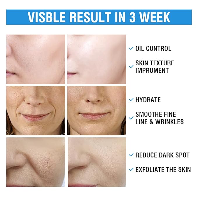 10% Glycolic Acid + 2% Salicylic Acid Peel Pads - BACHERI Resurfacing Pads For Face with Vitamins B5, C & E, Allantoin - Exfoliating Facial Peel for Dark Spots, Blackhead, Acne, 55 Pcs