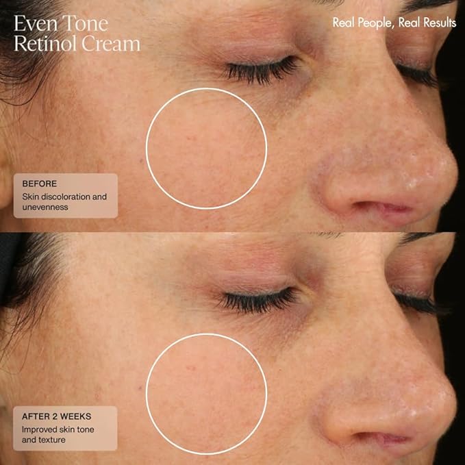 Senté Even Tone Retinol Cream | 0.5% Retinol Combined with HSA & Skin-Firming DSA | Improves Skin Tone, Texture, & Dark Spots | 1.0 Fl Oz