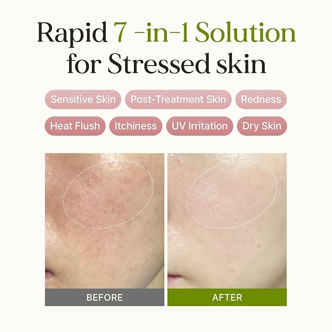 7 Relief Ampoule Pad (100 pads) – Quick Calming & Soothing Serum-Infused Toner Pads with 7 Herbal Blend, Moisturizing Comfort for Stressed and Sensitive Skin | Family-Friendly, Korean Skincare
