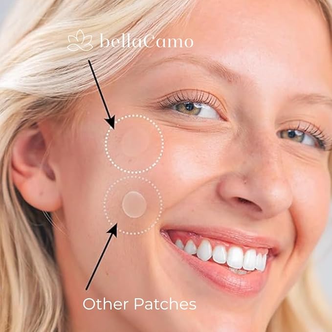 Pimple Patches – Hydrocolloid Acne Patches for Zits, Whiteheads & Blemishes, Fast Healing Zit Stickers, Invisible Pimple Spot Treatment for Face, Day or Night Use- 72 Count