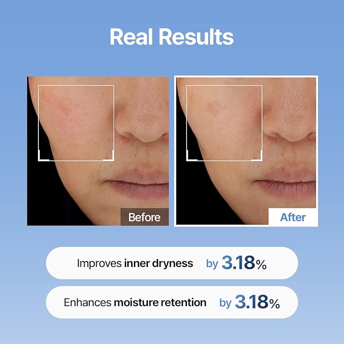 The Glass Skin Booster Duo – Retinal Skin Booster Serum + Ultra-Hydrating Hyaluronic Acid Serum (K-Beauty Set)