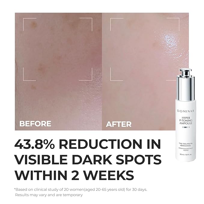 DOMINAS 10% Tranexamic Acid + 5% Mandelic Acid + 5% Niacinamide Brightening Serum, Powerful Dark Spot Corrector for Face, Fast Results in 2 Weeks, 1.01 fl oz
