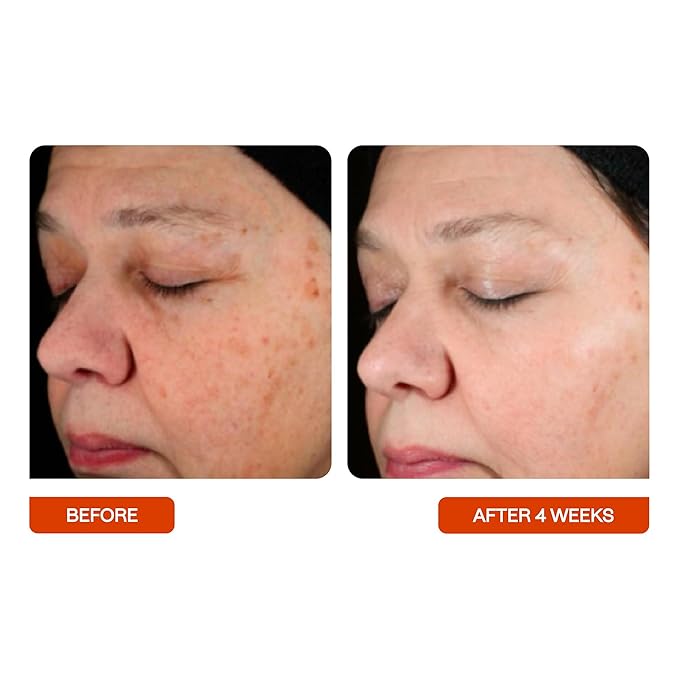 BeautyStat Universal C Skin Refiner - Vitamin C Serum for Face, 20% Pure L-Ascorbic Acid - Created by a 20+ Year Skincare Veteran Cosmetic Chemist (30ml / 1.0 oz)