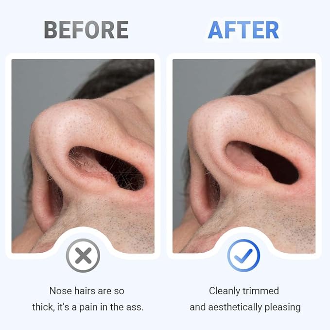BNGXR 2-in-1 Nasal Hair Cutter, 2026 Upgraded Double Sided Nose Hair Knife, Portable Manual 360° Rotating Nose Hair Trimmer with for Women Men, Beige (6)