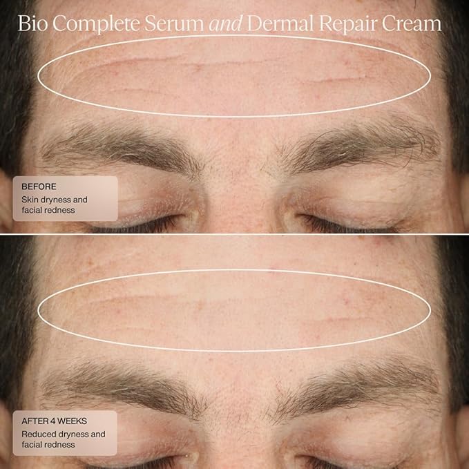 Senté The Repair Duo | Dermal Repair Ultra-Nourish & Bio Complete Serum | Complete Nighttime Skincare Set for Sensitive Skin | Helps Improve Tone, Texture & Hydration | 1.0 Fl Oz & 1.7 Fl Oz