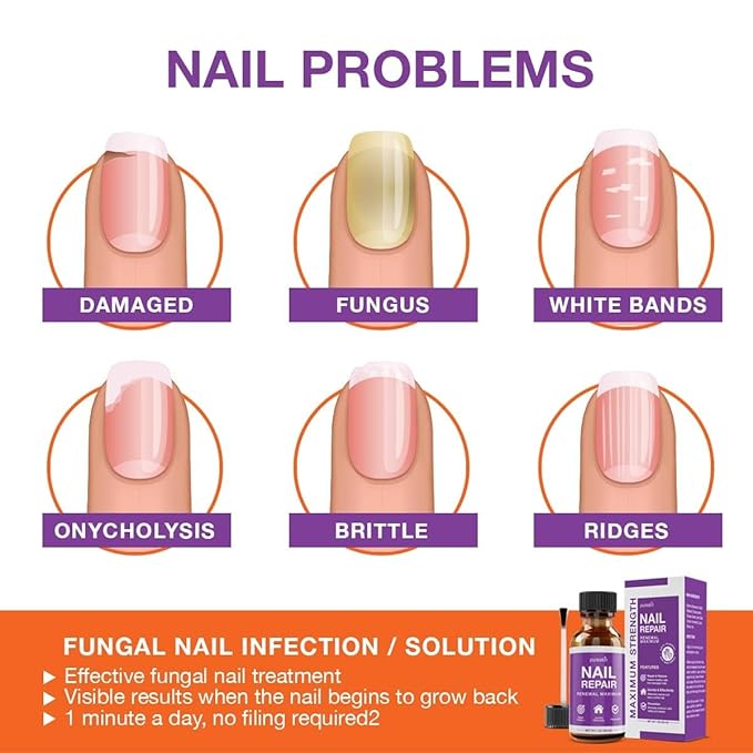 Toenail Fungus Treatment Extra Strength: Nail Fungus Treatment for Toenails and Fingernail for Damaged Discoloration Nails 1.0 Oz （New Formula）