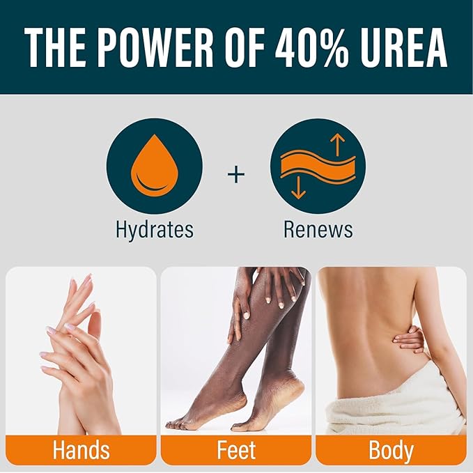 NUVADERMIS 40% Urea Cream - Full Body Moisturizing Cream for Extremely Dry Skin - Maximum Strength Urea Cream with 40 Percent Urea for Feet, Hands, Elbows & Body - Urea + Salicylic Acid – 5.3 fl oz