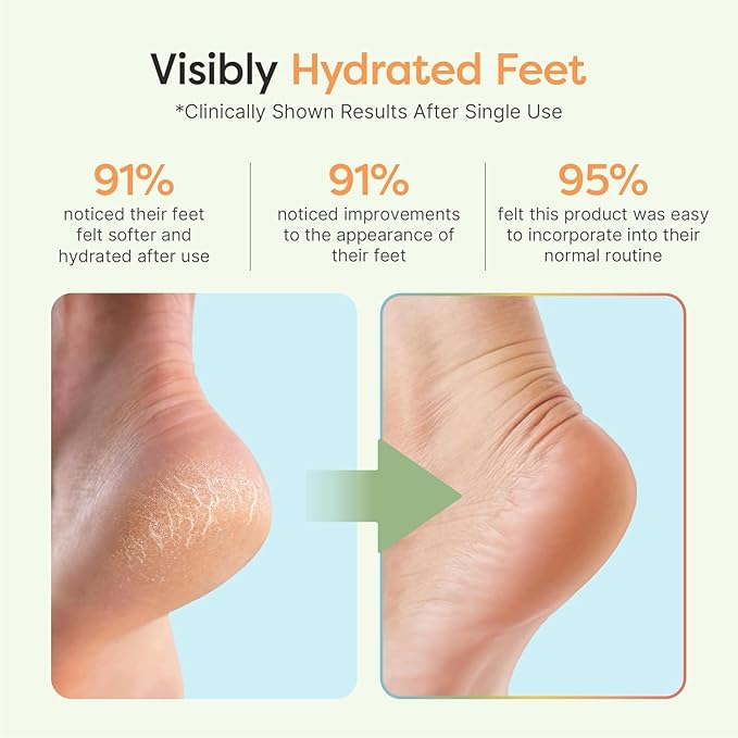 ZenToes Moisturizing Socks for Cracked Heel Treatment, Vitamin E, Olive Oil and Jojoba Oil Infused Heel Socks, Galentines Day Gifts, Self Care Gifts for Women (Cheetah, Regular)