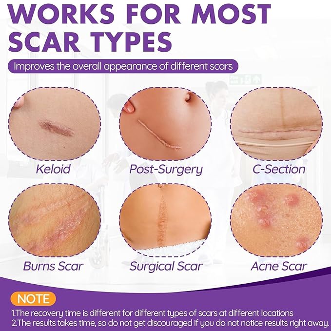Silicone Scar Sheets, Silicone Scar Tape(1.6"x 118" Roll-3M), Reusable Professional Scar Silicone Strips, Soft Silicone Scar Sheets for Surgical Scars,Keloid,Acne Scars,Burn Scar,C-Section
