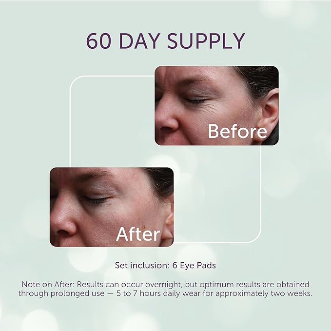 SilcSkin Silicone Eye Pads - Reusable Overnight Eye Patches, Medical-grade Silicone for Fine Lines, Crepey Skin, and Puffiness - 60 Day Supply