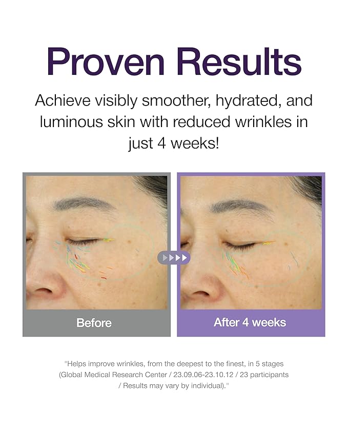 Centellian 24 360º Shot PDRN Active Serum (PDRN, 1.69fl oz) - Intense Hydration & Skin Firming Serum for a Youthful Appearance, Korean Skin Care. PDRN, Ribbon Collagen & Hyaluronic Acid.
