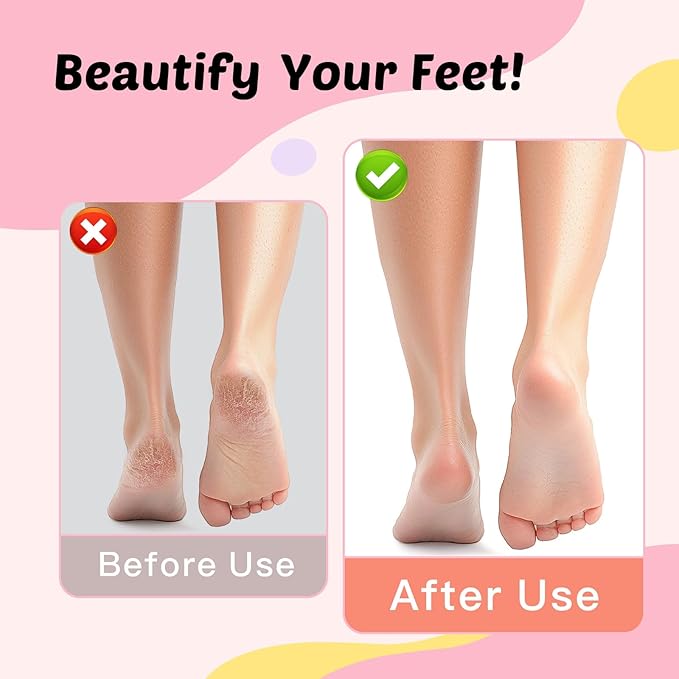 Dolcevitae Electric Foot Callus Remover & Nail File - Electric Callus Remover for Feet, 9 Adjustable Speeds, 1800mAh Rechargeable, Portable Aluminum Body w/Type-C Charging for Home & Travel (Black)