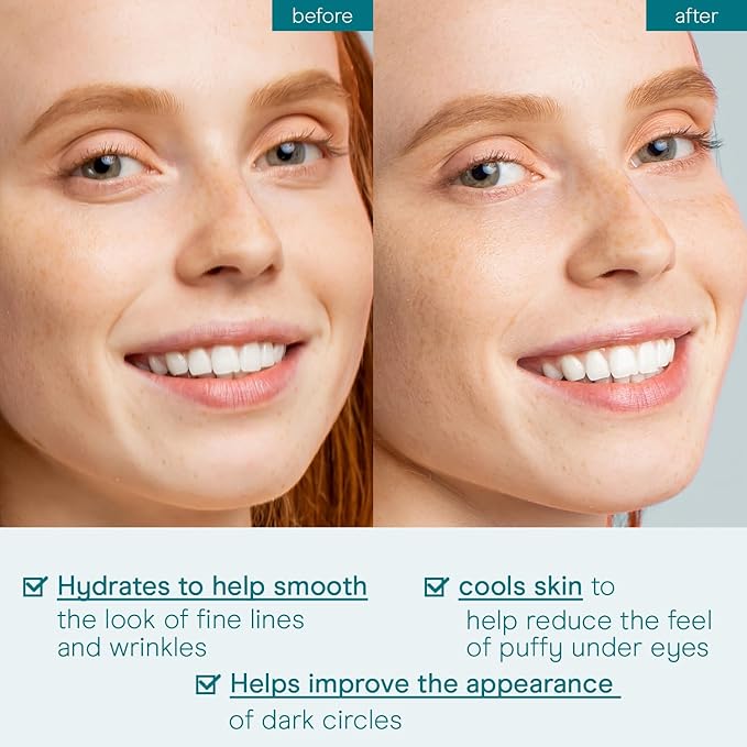 Baebody Under-Eye Gel - Advanced Cooling Under-Eye Cream For Dark Circles and Puffiness - Anti Aging and Hydrating - Beauty Gifts for Women (50 ml/1.7 fl oz)