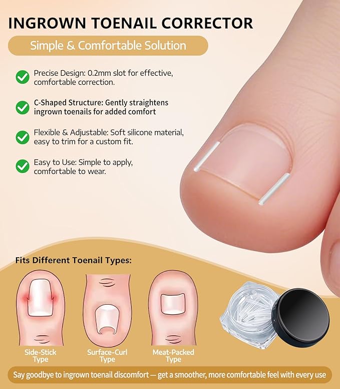 Ingrown Toenail Corrector Set with Correction Strips, Ingrown Toenail Removal Kit, Professional Ingrown Toenails Pedicure Tool Set, Curved Toenails Corrector Patch