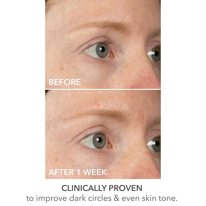 Dr Dennis Gross DermInfusions Lift + Repair Eye Mask | Visibily Lift + Firm, Fills the Appearance of Fine Lines, Hydrates + Repairs Skin Barrier, Visibly Depuffs Undereye Area | 1 Treatment 0.33 fl oz