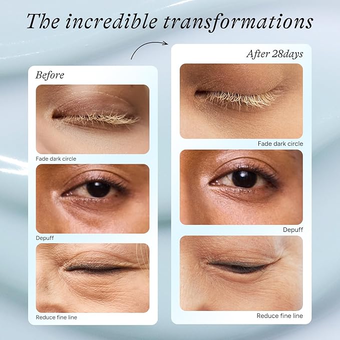 Caffeine Eye Serum, Firming Hydrating Renewing Eye Cream with Bakuchiol Hyaluronic Acid for Reduces Fine Lines, Dark Circles & Puffy Bags, Eyes Care with Zamak Applicator, 0.5 fl. oz