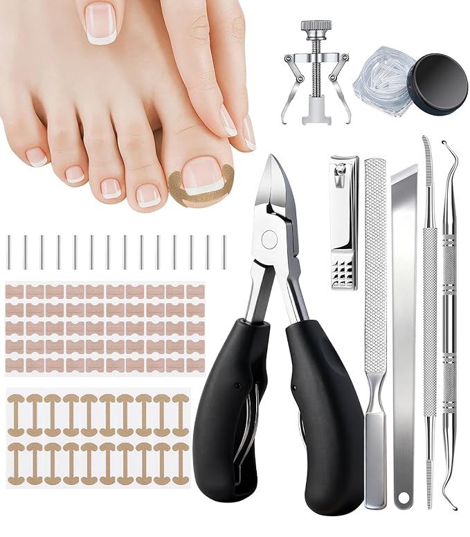 Ingrown Toenail Corrector Set with Correction Strips, Ingrown Toenail Removal Kit, Professional Ingrown Toenails Pedicure Tool Set, Curved Toenails Corrector Patch