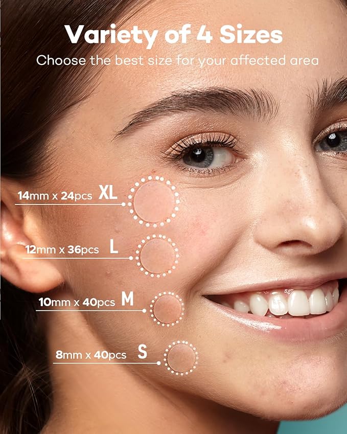 TKTK Pimple Patch Acne Patch, 4 Sizes 420 Patches Acne Absorbing Cover Patch, Hydrocolloid Invisible Acne Patches For Face Zit Patch Acne Dots Tea Tree, Calendula Oil - 3 Pack