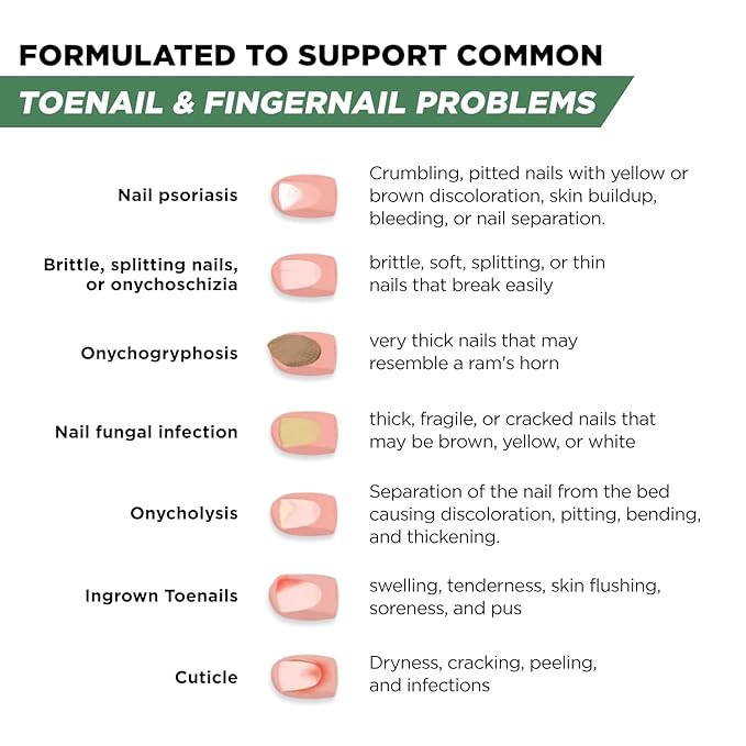 Foot Cure Toenail Fungus Treatment Extra Strength – Athletes Foot Treatment for Toenails, Restorative Nail Repair for Damaged Nails, Toenail Softener with Tea Tree Oil & Oregano Oil - Made in USA