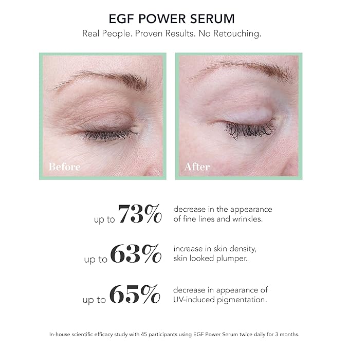 BIOEFFECT EGF Power Serum | Barley-Derived EGF + KGF + Hyaluronic Acid | Intensive Anti-Aging Face Treatment for Deep Wrinkles, Firmness & Skin Renewal, 15 mL / 0.50 oz