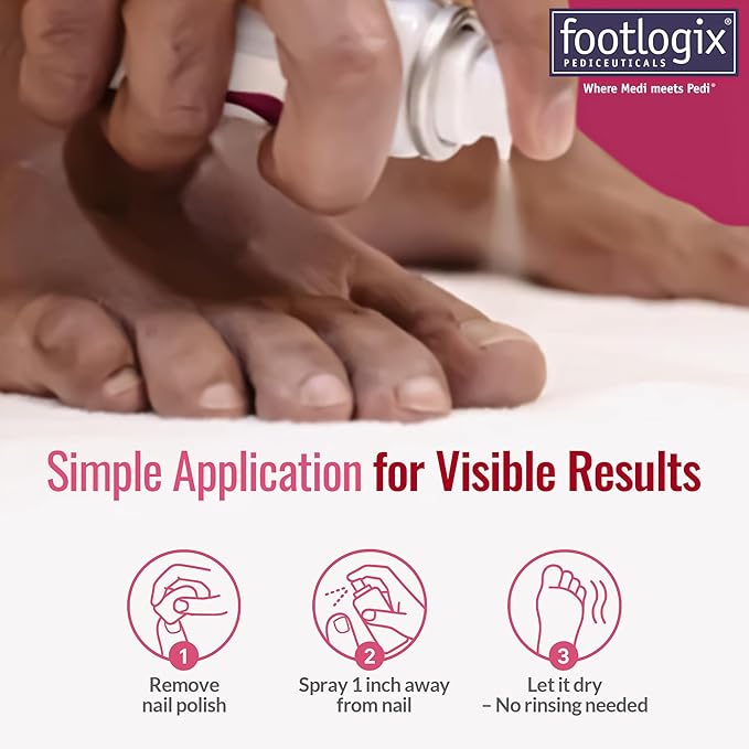 FOOTLOGIX Nail Tincture Spray with Spiraleen, 1.69 Fl Oz (Pack of 1)