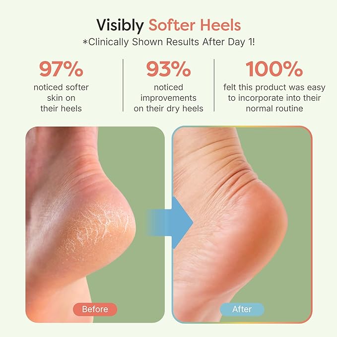 ZenToes Moisturizing Socks for Cracked Heel Treatment, Vitamin E, Olive Oil and Jojoba Oil Infused Heel Socks, Galentines Day Gifts, Self Care Gifts for Women (Fuzzy Mint Green, Regular)
