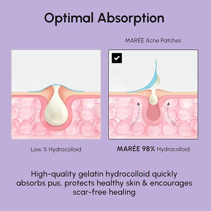 MAREE Star Pimple Patches for Face - Hydrocolloid Acne Patches w/Salicylic Acid, Tea Tree Oil & Centella - Cute Pimple Patches Stars - Teens Zit Patches Stickers - Parches Para Acne - 72 Blemish Dots