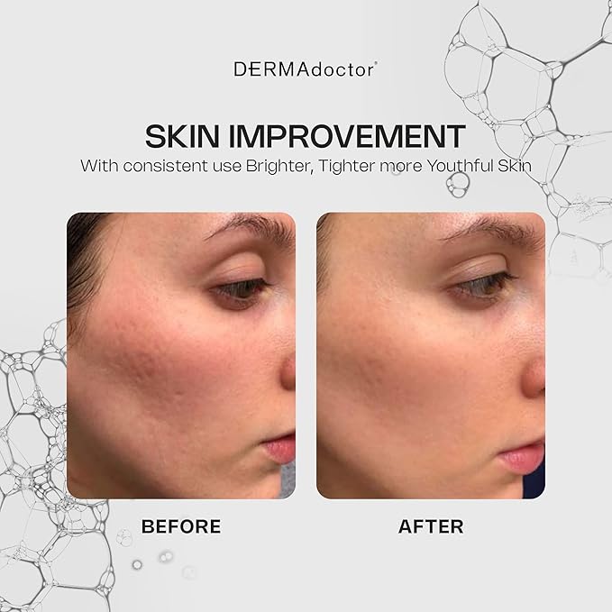 DERMAdoctor Vitamin C Serum For Face 20% Vitamin C, Vitamin-E, Ferulic Acid, Ascorbic Acid Concentrated Dermatologist-Formulated Anti Aging Face Serum, Hydrating & Discoloration - 1.0 fl oz