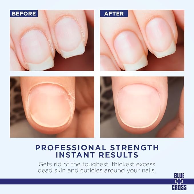 Cuticle Remover & Softener Liquid for Nails – Blue Cross Professional Nail Care with Lanolin, Hydrating Treatment for Dry Cuticles & Hangnails, Made in USA, 16oz