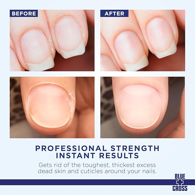 Cuticle Remover & Softener Liquid for Nails – Blue Cross Professional Nail Care with Lanolin, Hydrating Treatment for Dry Cuticles & Hangnails, Made in USA, 6oz