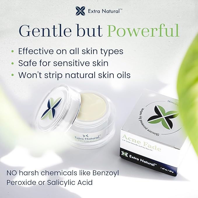 ExtraNatural Acne Cream – Natural & Gentle Acne Treatment for Sensitive & Oily Skin – Helps Reduce Breakouts, Pimples & Redness