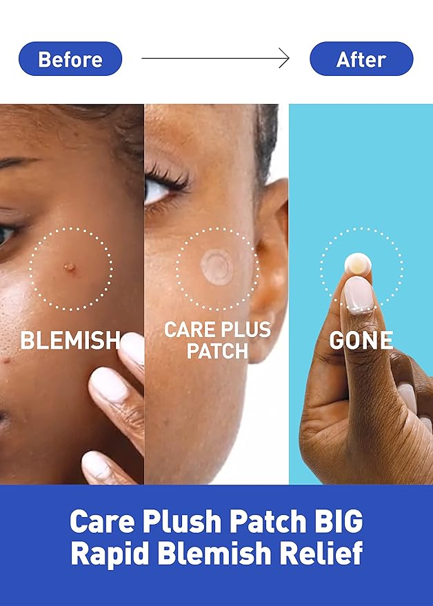 OLIVE YOUNG Care Plus Spot Patch | Hydrocolloid Acne Korean Spot Patch to Cover Zits, Pimples and Blemishes, for Troubled Skin and Face (Hydrocolloid, 15 Count (Pack of 1))