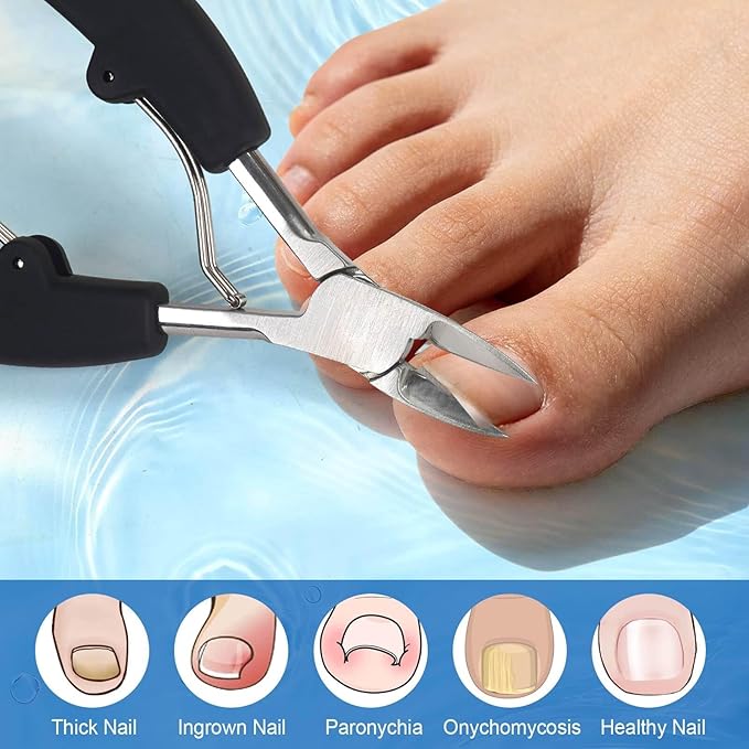 TEAORB Ingrown Toenail Clippers, Professional Stainless Steel Toe Nail Clippers, Professional Toenails Trimmer for Thick Nail & Ingrown Toenails, Heavy Duty Pedicure Tools.