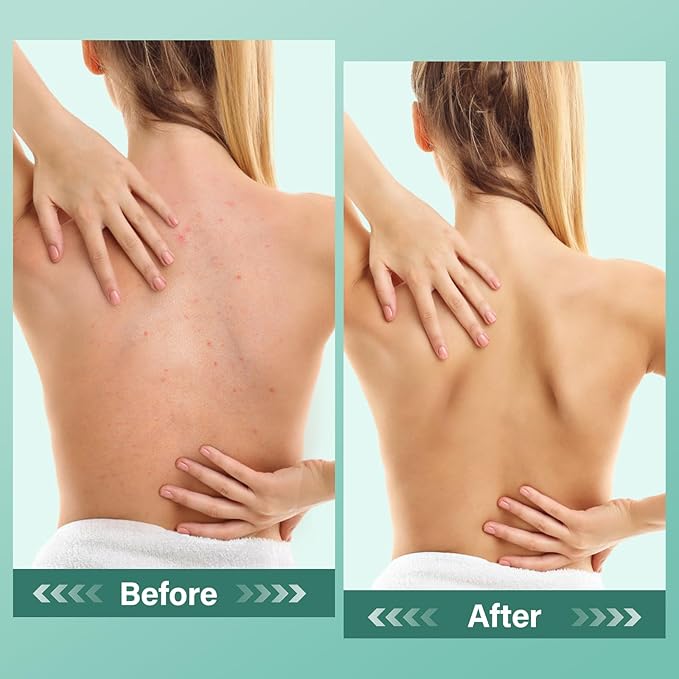 Eucalyptus Epsom Salt Body Scrub,Exfoliating detox body scrub,Relax & Relief with Eucalyptus & Spearmint Essential Oils, Deeply Nourishes for Smooth, Radiant Skin–Valentine’s Day Gift for Her/Him