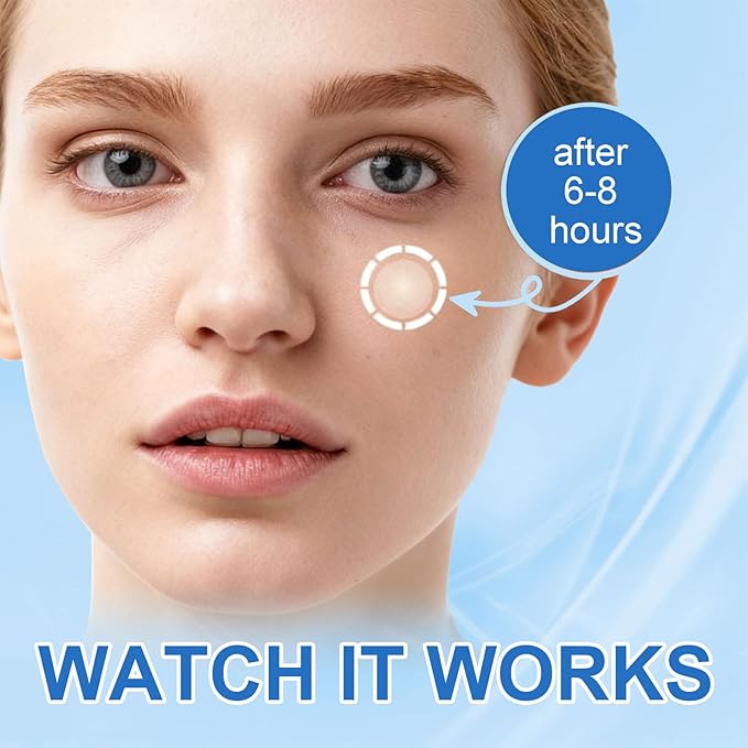 Amouy Acne Pimple Patch- 2 Sizes 432 Dots Thin & Thick Hydrocolloid Patches for Face with Witch Hazel, Tea Tree & Calendula Oil, Extra Adhesion Pimple Patches for Face Zit Patch Acne Dots