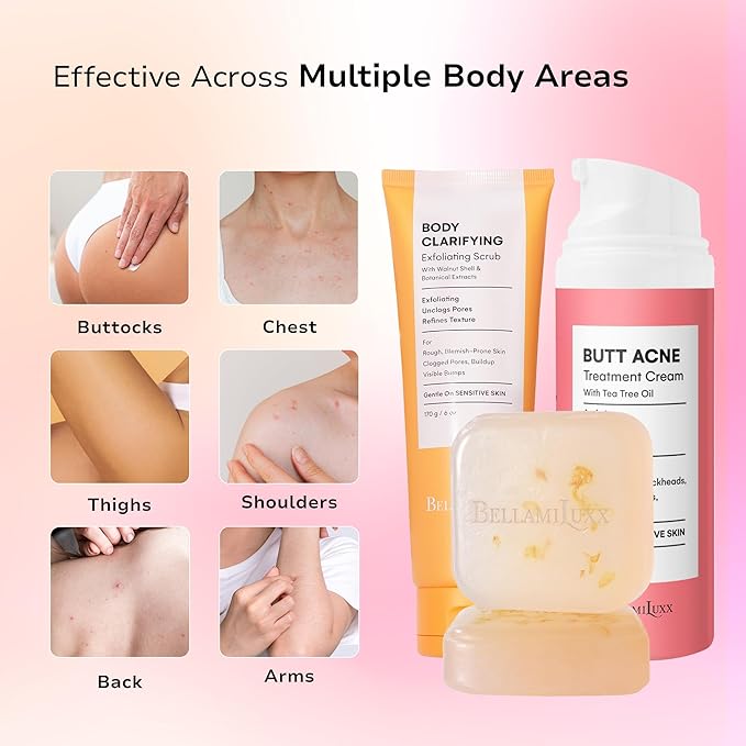 Butt Acne Treatment Set: Acne Soap Bar + Butt Treatment Lotion for Breakouts on Buttocks, Thighs, Back, Chest & Ingrown-Prone & Folliculitis-Prone Skin – Helps Reduce Body Breakouts