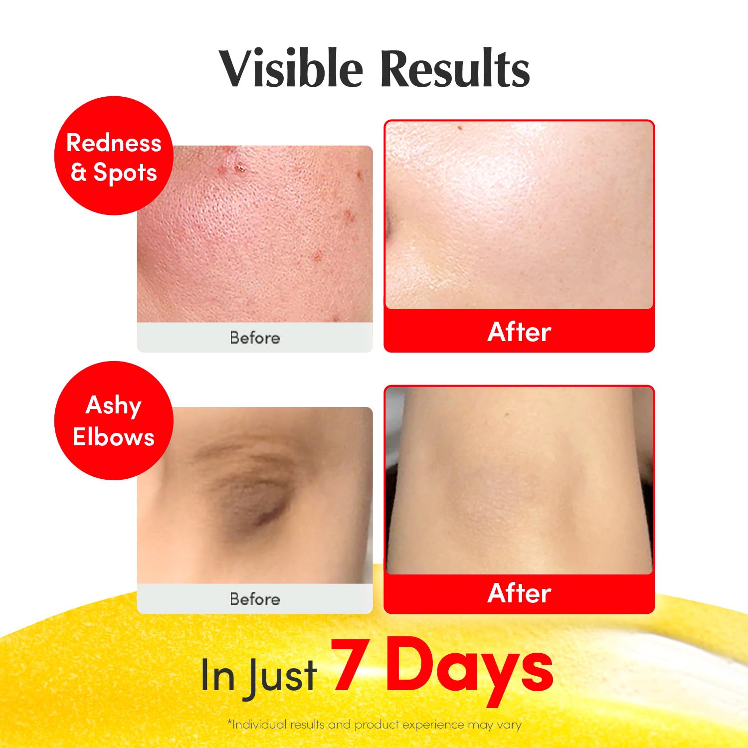 Vitamin Illuminating Serum | Niacinamide 4% + Brightening Vitamin C Face Serum with Hyaluronic Acid & Vitamin E | Dark Spot, Uneven Tone Care | Korean Skincare, 1.01 Fl.Oz