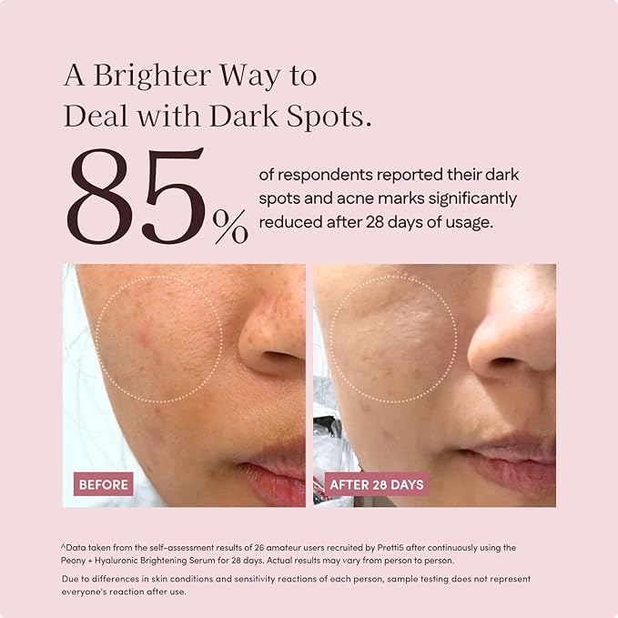 Botanic Pretti5 Peony+ Hyaluronic Brightening Serum for Uneven Skin Tone, Hyperpigmentation & Hydration, Lightweight, Clean Formula, Sensitive-Skin Friendly
